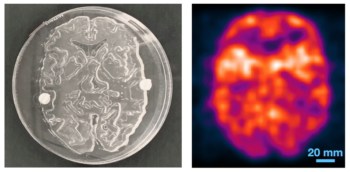 Direct positron emission imaging