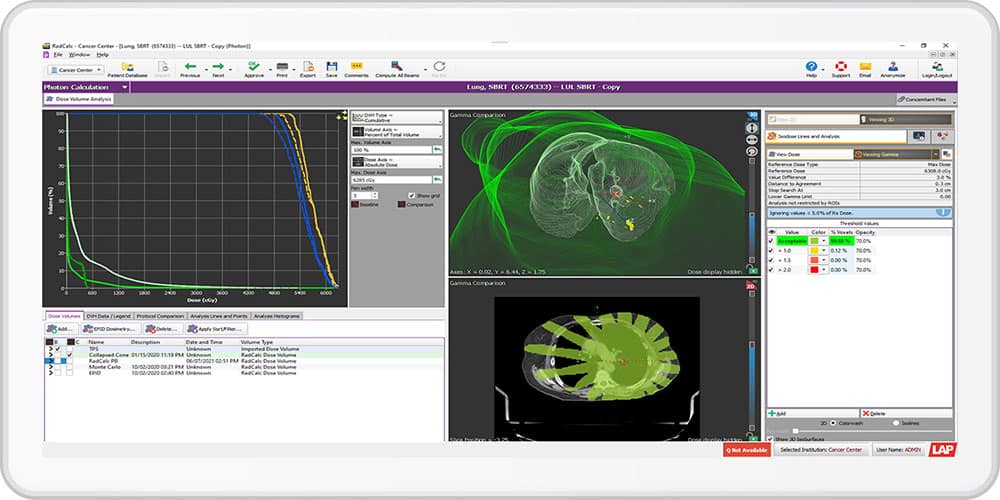 Medical implementation of RadCalc’s automated 3D collapsed cone secondary dose examine – Physics World