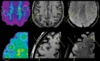 Imaging multiple sclerosis patients