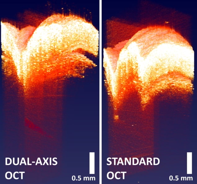 Dual-axis OCT images deeper into tissue