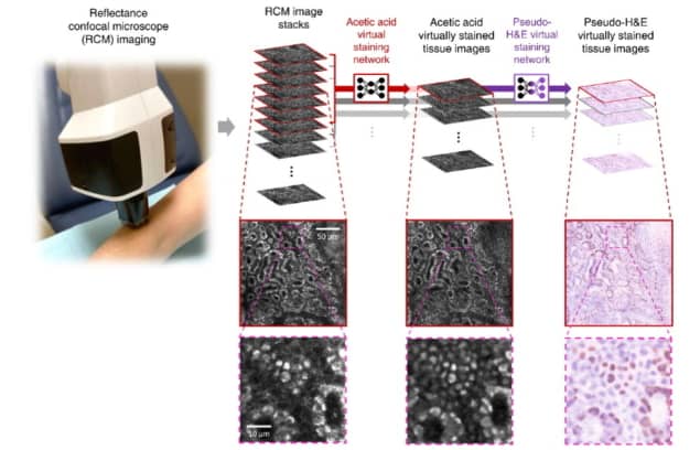 Non-invasive skin diagnosis Non-invasive skin diagnosis