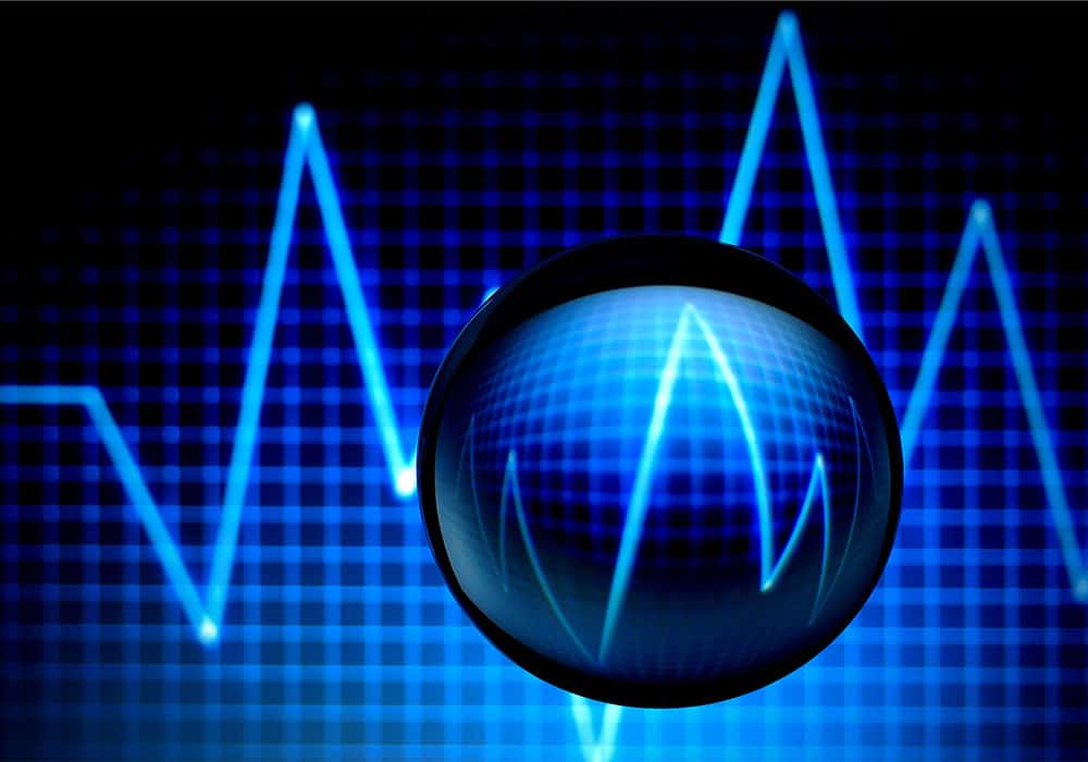 Current advances in photoplethysmography – Physics World