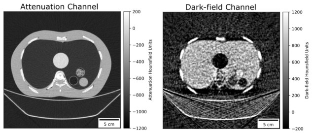 Dark-field CT reconstruction