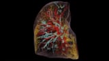 3D image of a human lung