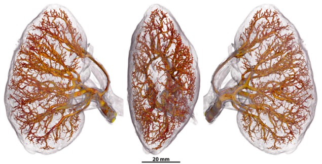 Three HiP-CT images of human kidneys