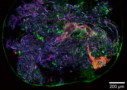 Multiphoton microscopy image of lung tissue