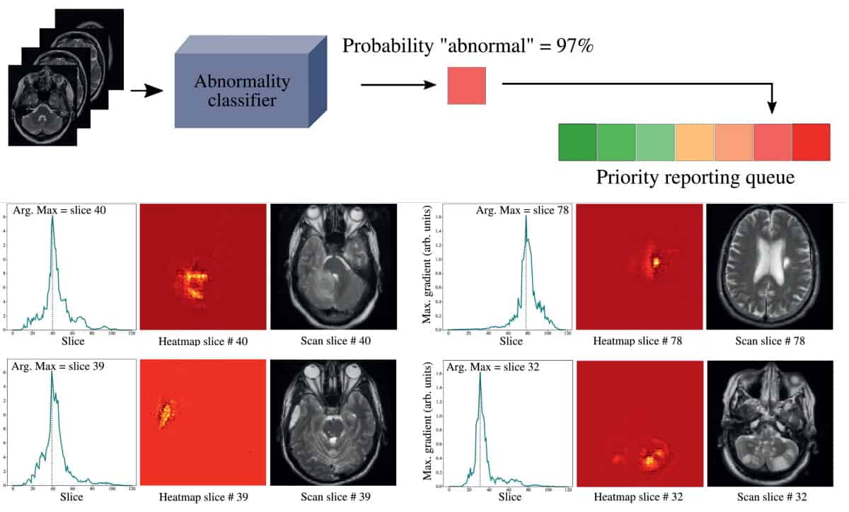 King's College London on LinkedIn: Brain scans reveal exactly why