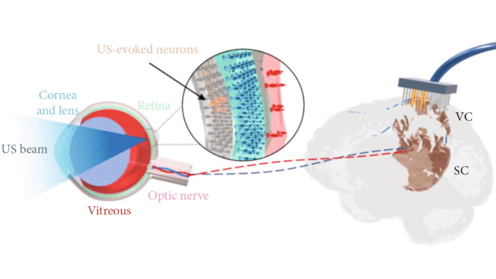 Biophysics and bioengineering Archives – Physics World