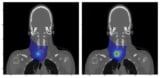 MRT dosimetry