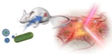 Photothermal cancer immunotheranostics