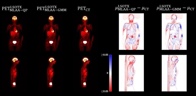 Advances in nuclear medicine technology reduce radiation exposure and ...