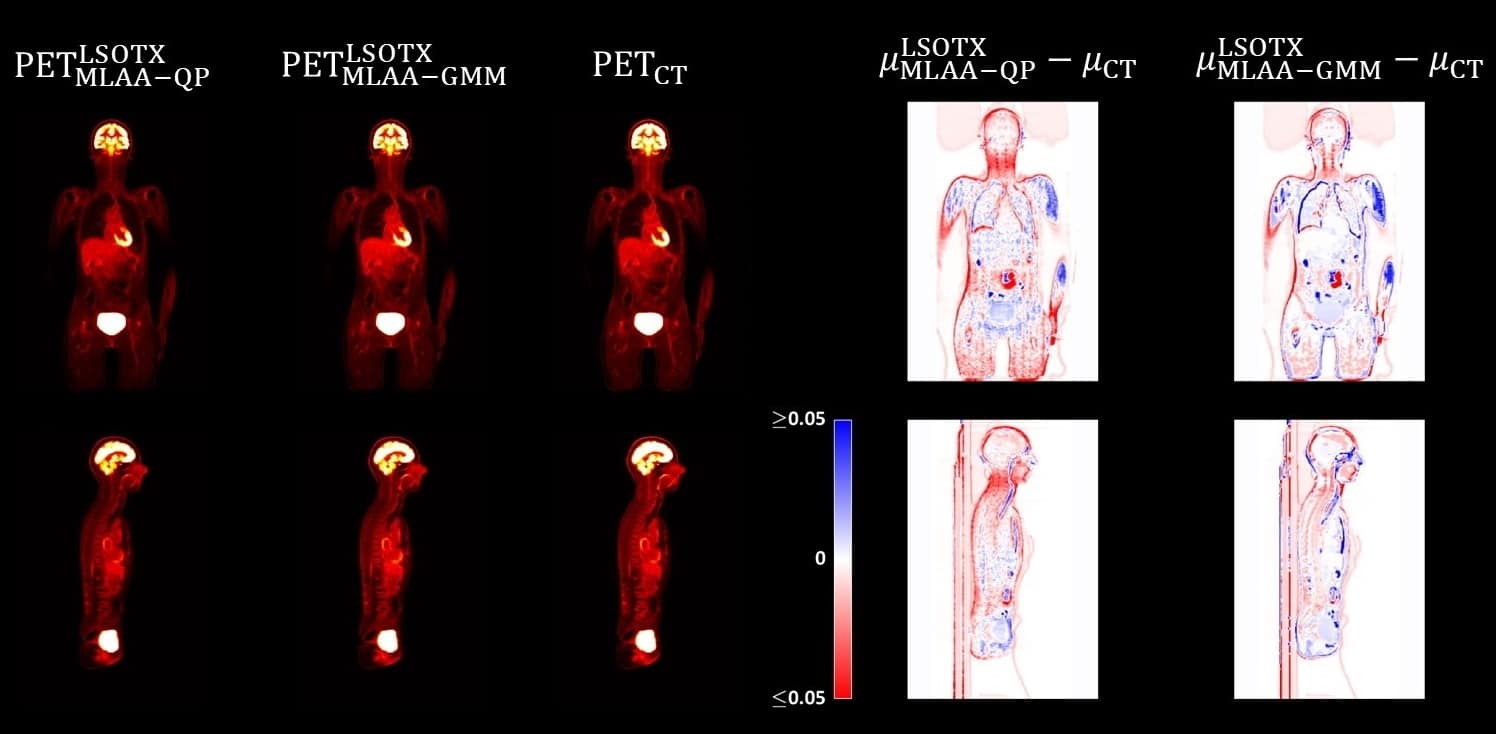 Radiation Effects From Body Scan Minimal