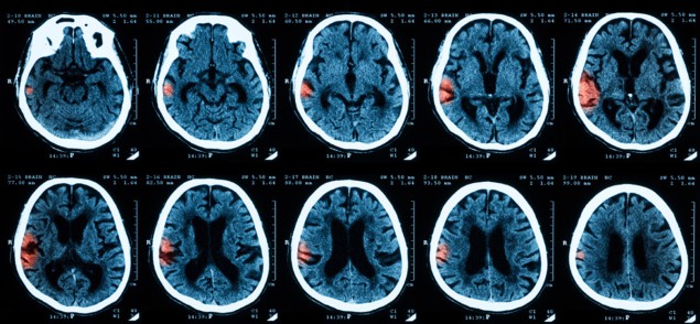 Head CT scans