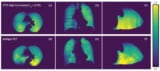 ニューラルネットワークによるCT換気画像