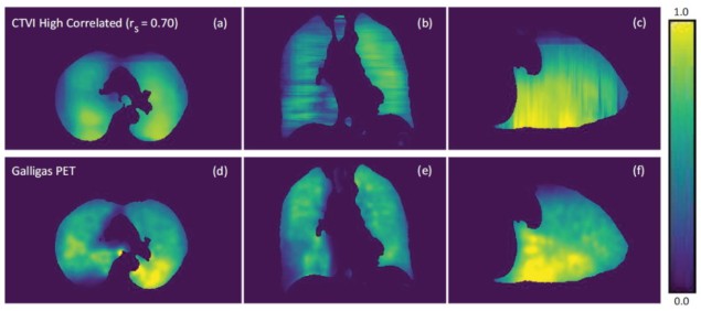 Neural network-produced CT ventilation images