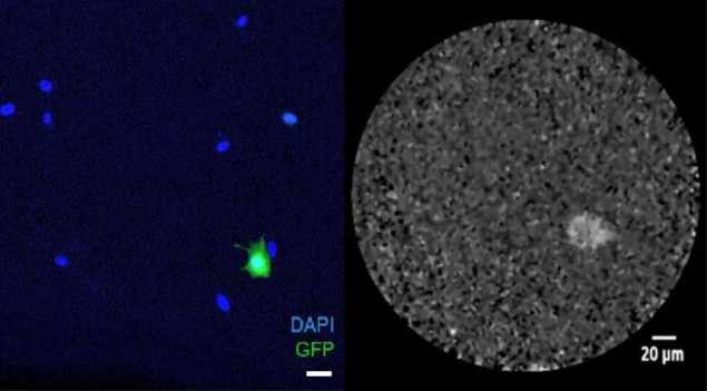 Seeing single cells