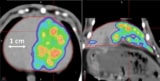 CT-based dose distribution