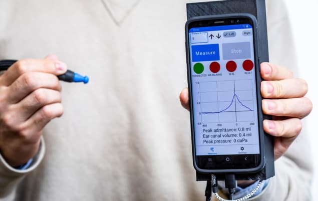 Smartphone-based tympanometer