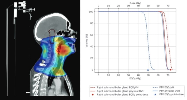 Radiotherapy treatment plans