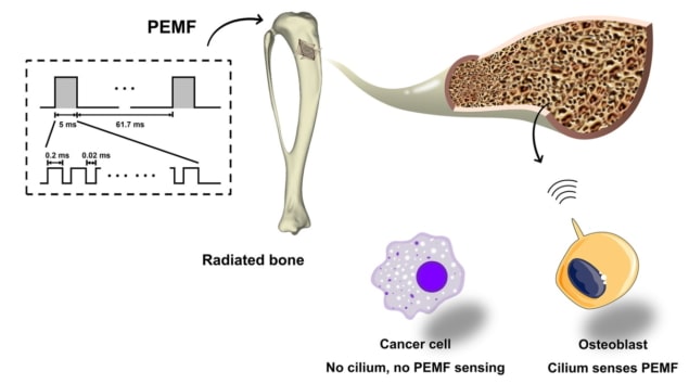 Pulsed-burst EMF prevents radiotherapy-induced bone loss