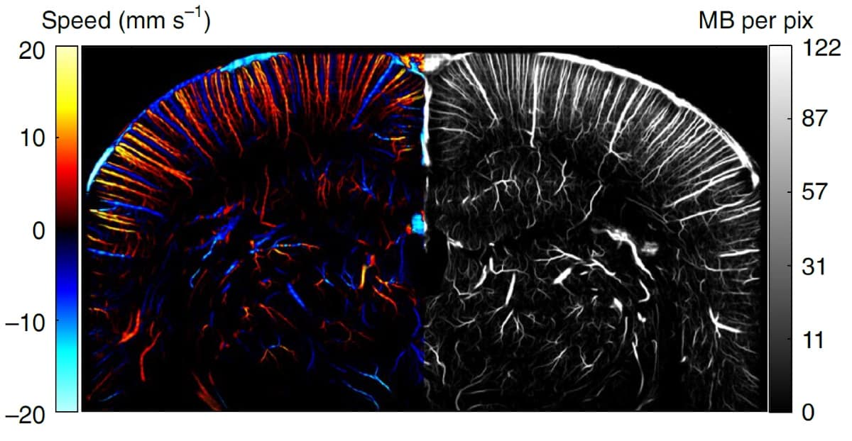 Medical optical imaging using the world's first 'ultrasound