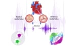 Heart sound maps