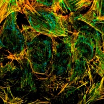 The Luminosa confocal microscope
