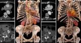 CT angiography images