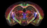 MR imaging of the mouse brain