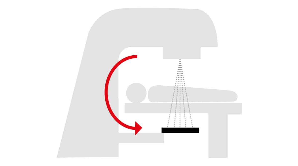 The forward approach for in vivo EPID dosimetry