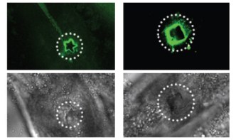 3D printing in a living organism