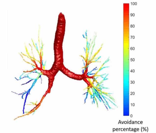 Functionally weighted airway sparing