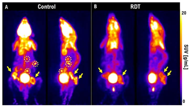 Radiodynamic therapy: harnessing light to improve cancer treatments ...
