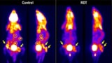 PET scans of a control mouse and a mouse after radiodynamic therapy