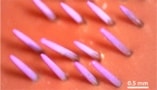 Image showing an array of microneedles coated with a dyed-pink DNA vaccine. The pink needles are poking up out of an orange background