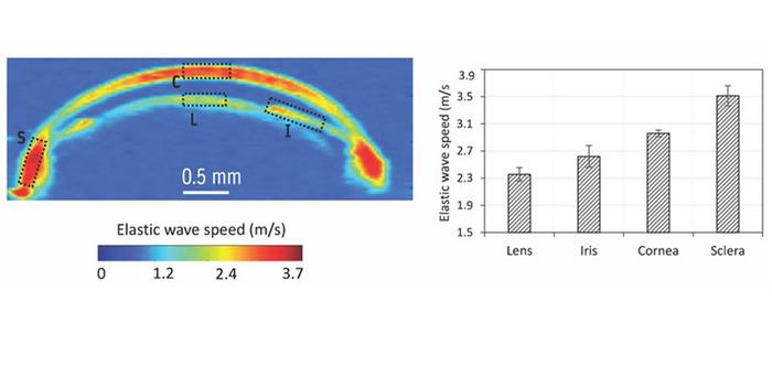 https://physicsworld.com/wp-content/uploads/2023/10/Low-Res_Eye-elasticity-920.jpg