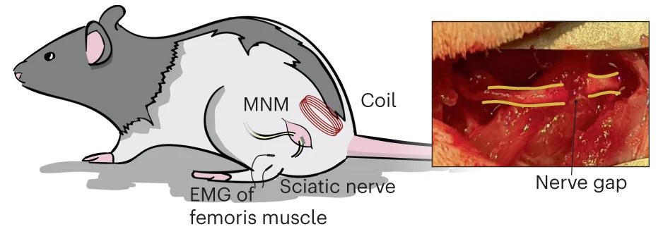 Restoring conduction across a severed nerve
