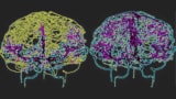 Modelling blood flow in the brain