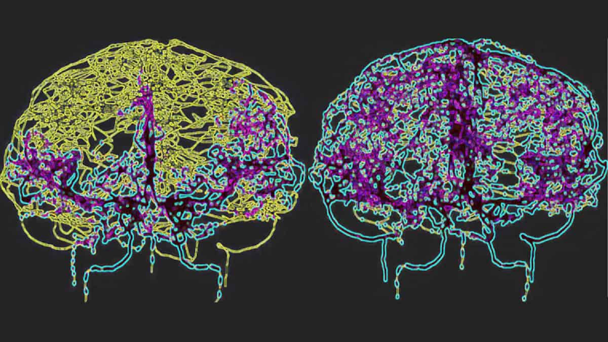 FLASH irradiation spares immune cells during proton therapy – Physics World