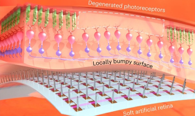 Artificial retina schematic