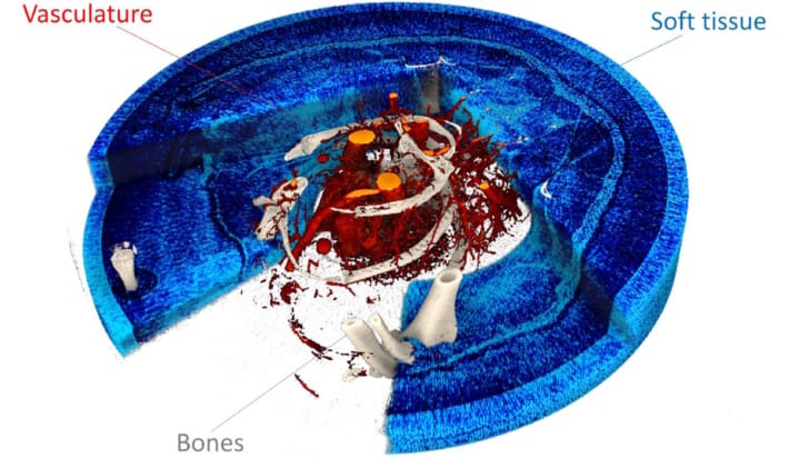 Spectral phase-contrast tomography