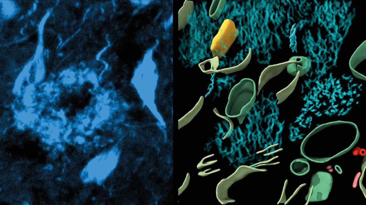 Cryo-electron tomography reveals structure of Alzheimer’s plaques and tangles in the brain – Physics World