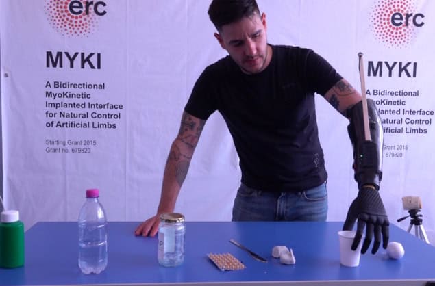 Robotic prosthesis user grasps a fragile plastic cup