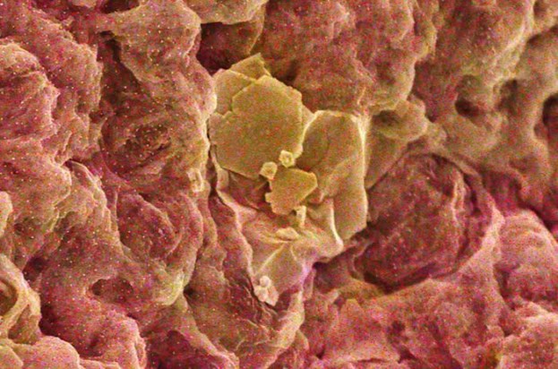 A scanning electron microscope image of Au3+ extraction and reduction by the graphene oxide/chitosan sponge. The Au3+ appears as a yellow blob stuck to a pink-tinged, lumpy background