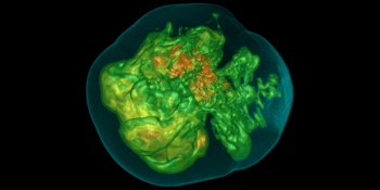 Image of a simulation of a core-collapse supernova, which looks like a messy, uneven green object inside a bubble