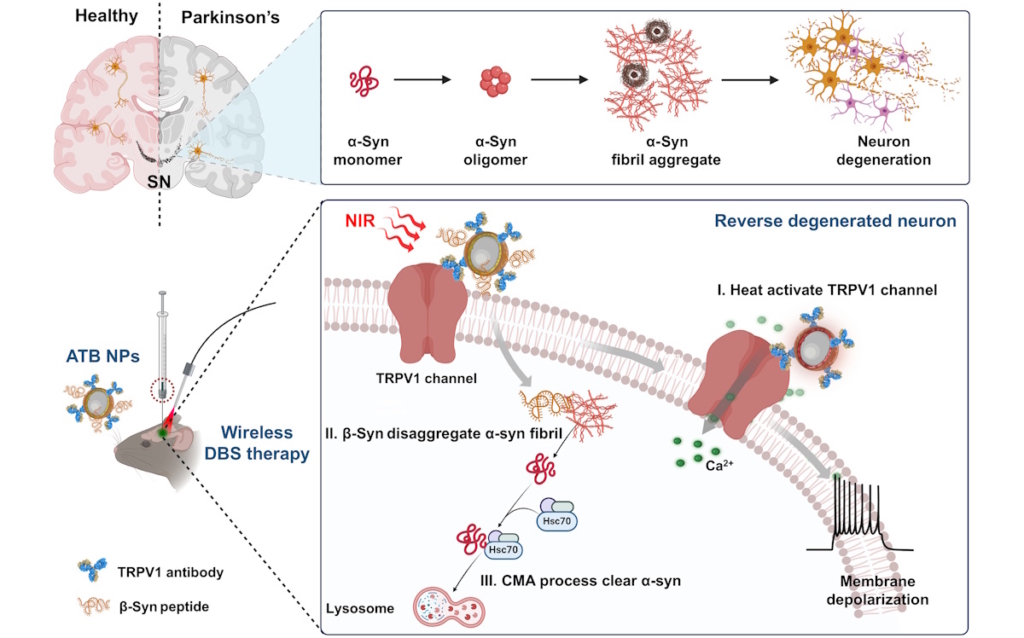 Wireless deep brain stimulation reverses Parkinson’s disease in mice ...