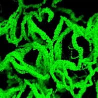 Confocal microscope image showing cables formed by bacterial cells. The cells appear to be glowing green against a black background and the cables resemble a pile of partially wadded-up rubber bands or strings