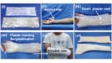 Smart plaster cast