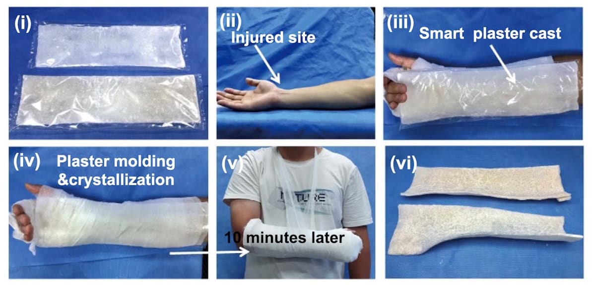 Smart plaster cast