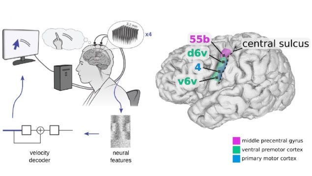 Cursor control using a brain-computer interface Cursor control using a brain-computer interface